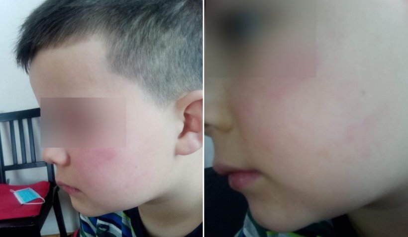 Băieţel de 7 ani, bătut de tatăl unei colege, sub privirile îngrozite ale învățătoarei