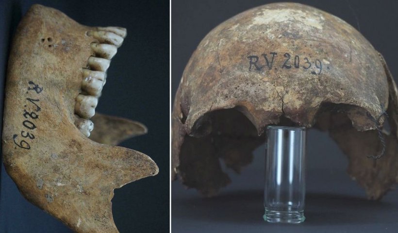 Primul om infectat cu ciuma care a decimat jumătate din Europa a trăit acum peste 5.000 de ani