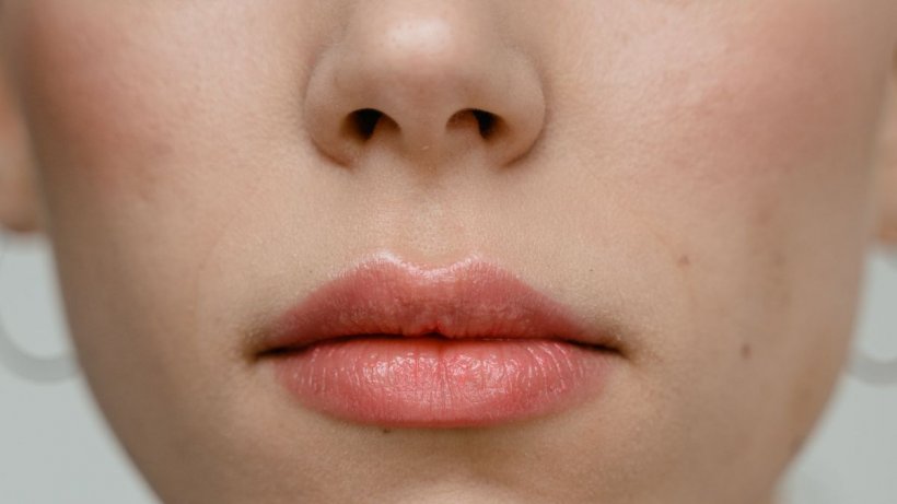 Simptomul Omicron care apare pe piele, buze și unghii. Este ușor de observat