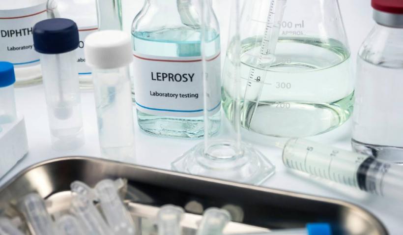 Un caz de lepră a fost confirmat la Cluj. Alte trei sunt sub evaluare, pacientele sunt maseuze din Asia