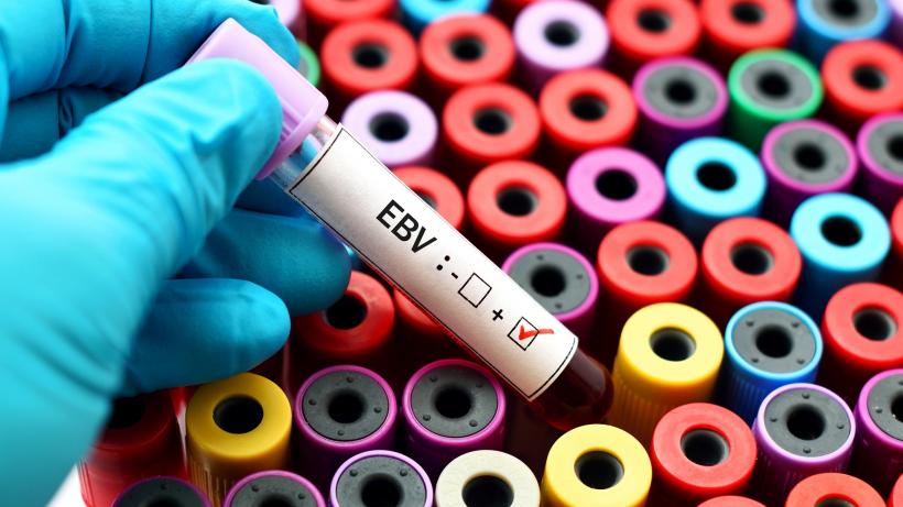 Virusul pe care 95% dintre oameni îl vor avea toată viața