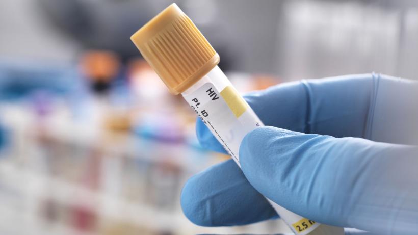 Caz medical extrem de rar. Un bărbat a fost vindecat de HIV după un transplant de celule stem chiar de la fratele lui