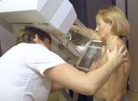 Cancerul de sân, depistat printr-o simplă analiză de sânge, din 2008