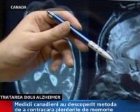 Medicii canadieni ajută bolnavii de Alzheimer să-şi recupereze memoria