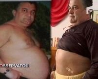 Un primar din Argeş şi-a făcut liposucţie, ca să fie reales