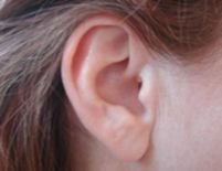 Razele infraroşii, o nouă speranţă pentru persoanele cu deficienţe de auz