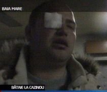 Bataie la cazinou. Trei tineri din Baia Mare au ajuns la spital după o altercaţie cu bodyguarzii