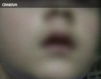 Un băiat de 12 ani, muşcat de buză de tatăl unui coleg de şcoală