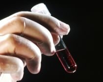 Pacient bolnav de SIDA, trimis în oraş la analize cu probele de sânge în mână
