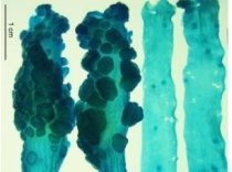 Bacteria care cauzează cancerul la colon, identificată de cercetătorii americani