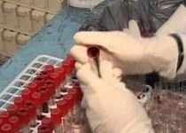 Cancerul de colon ar putea fi depistat cu ajutorul unui simplu test de sânge (VIDEO)