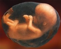 România, locul trei în Europa, la numărul de avorturi