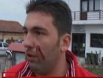 Primarul din Tărtăşeşti, acuzat că a agresat fizic un fost angajat (VIDEO)