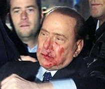 Silvio Berlusconi, lovit în faţă la o manifestaţie de la Milano