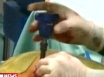 Hernia de disc poate fi operată şi în România, fără bisturiu