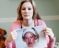 Desfigurată de paracetamol: O tânără a ajuns în stare gravă la spital, după ce a luat o pastilă