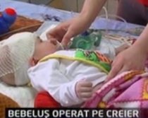 Premieră medicală: Un bebeluş de patru luni a fost operat pe creier (VIDEO)