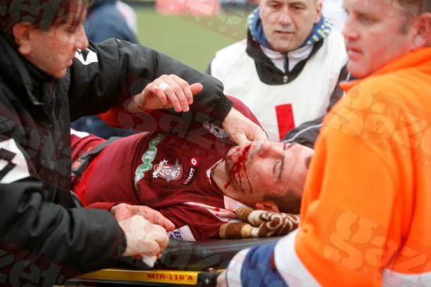 Durităţi în Liga I: Fernandes, umplut de sânge la Alba Iulia. Patru dinamovişti la infirmerie după derby-ul cu CFR