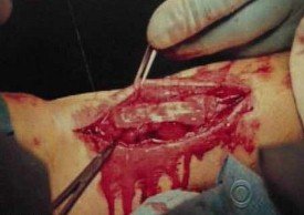 Beckham prezintă o fotografie din timpul operaţiei la tendonul lui Ahile, în emisiune la Letterman (VIDEO)