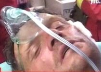 Un cioban are faţa sfâşiată după ce a fost atacat de o ursoaică (VIDEO)