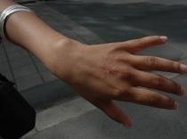 Consulul Cubei la Oslo a muşcat de mână o tânără în timpul unui protest (VIDEO)