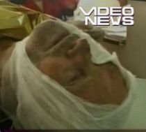 Iaşi. Un bătrân a fost lăsat să putrezească în baie de rudele cu care locuia (VIDEO)