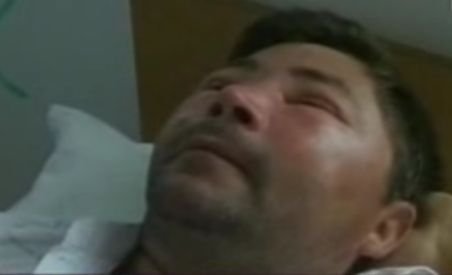 Iaşi. Un bărbat a ajuns în stare gravă la spital după ce a fost atacat de viespi (VIDEO)