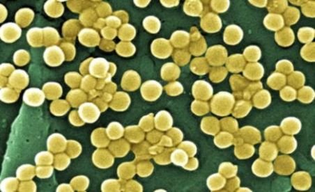 Apune era antibioticelor? Enzima NDM 1 face bacteriile rezistente la tratament