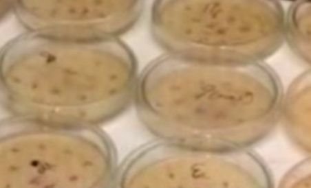 Superbacteria descoperită în Pakistan a făcut prima victimă în Europa. Un belgian a murit la revenirea în ţara sa (VIDEO)