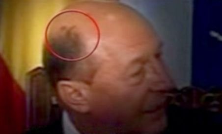 Preşedinţia despre petele suspecte apărute pe capul lui Traian Băsescu: Nu sunt motive de îngrijorare (VIDEO)