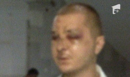 Tânărul desfigurat în bătaie înainte de meciul Steaua - Dinamo aşteaptă să i se facă dreptate