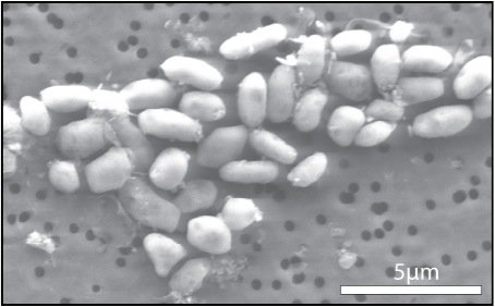 NASA anunţă existenţa unei bacterii care se hrăneşte cu arsenic: Va ajuta la descoperirea altor forme de viaţă