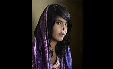 Portretul desfigurat al unei femei afgane, cea mai bună fotografie de presă a anului 2010