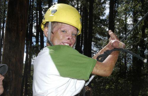 Un băiat român mutilat într-un incendiu, îngrijit exemplar în SUA 89938