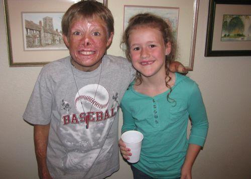 Un băiat român mutilat într-un incendiu, îngrijit exemplar în SUA 89939