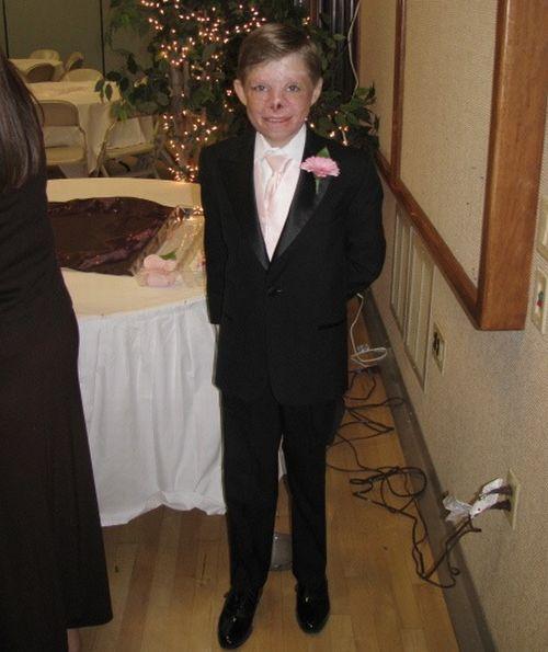 Un băiat român mutilat într-un incendiu, îngrijit exemplar în SUA 89941