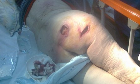 Imagini şocante. Cum arată o pacientă &quot;îngrijită” într-un spital din Constanţa