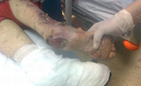 Imagini şocante. Cum arată o pacientă &quot;îngrijită” într-un spital din Constanţa 92947