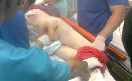 Imagini şocante. Cum arată o pacientă &quot;îngrijită” într-un spital din Constanţa 92948