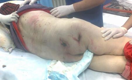 Imagini şocante. Cum arată o pacientă &quot;îngrijită” într-un spital din Constanţa 92949