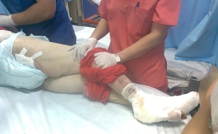 Pacienta neglijată de la Băneasa, plimbată din spital în spital
