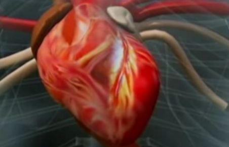 O simplă injecţie ar putea reface complet muşchiul inimii după un infarct