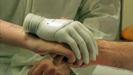 Mâna bionică, proteză de ultimă generaţie testată de un australian