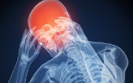 Crizele de epilepsie ar putea fi tratate cu ajutorul unui implant cerebral