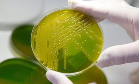 Primul caz de infecţie cu bacteria E.coli, confirmat în Polonia