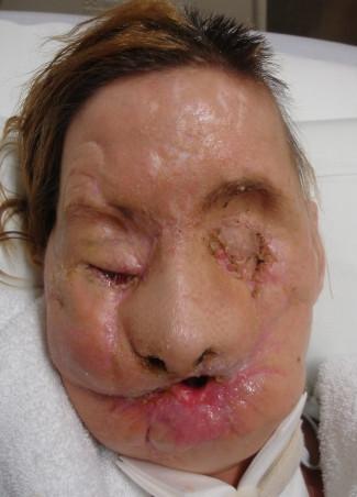 Săptămâna în imagini - fenomene meteo spectaculoase, operaţii rare, sărăcie 98256