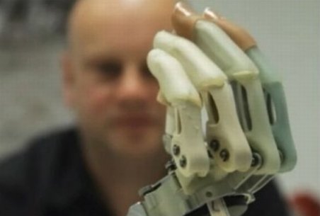 Un student din Iaşi a construit o mână bionică. Dispozitivul ajută şi la operaţii chirurgicale