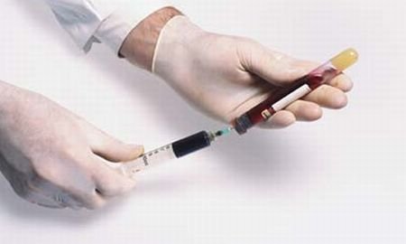 OMS avertizează: Lumea, la un pas de epidemie de hepatită
