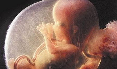 Medici din Iaşi suspectaţi că au făcut avorturi ilegale: 1.000 de euro pentru o întrerupere de sarcină