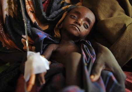 Peste 29.000 de copii au murit în ultimele 90 de zile din cauza foametei din Somalia